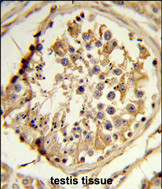 Anti-C14orf145 antibody, Internal used in IHC (Formalin-fixed paraffin-embedded sections). GTX80638