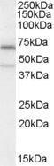 Anti-C14orf169 / NO66 antibody, Internal used in Western blot. GTX88860
