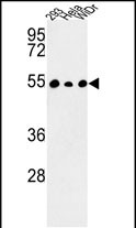 Anti-C14orf50 antibody, N-term used in Western blot. GTX80637