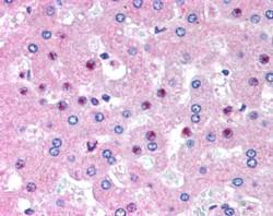 Anti-C14orf68 (aa242-254) antibody, Internal used in IHC (Formalin-fixed paraffin-embedded sections). GTX89170