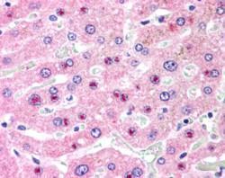 Anti-C14orf68 antibody, Internal used in IHC (Formalin-fixed paraffin-embedded sections). GTX89144
