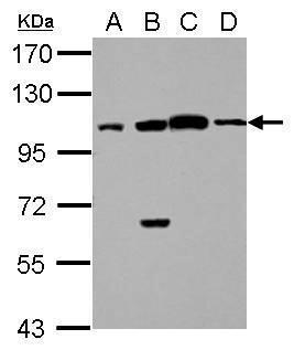 Anti-C17orf70 antibody [C2C3], C-term used in Western blot. GTX116871