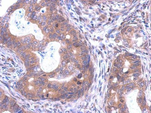 Anti-C18orf24 antibody used in IHC (Formalin-fixed paraffin-embedded sections). GTX119803