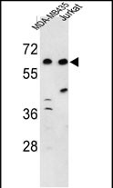 Anti-C19orf26 antibody, Internal used in Western blot. GTX80447