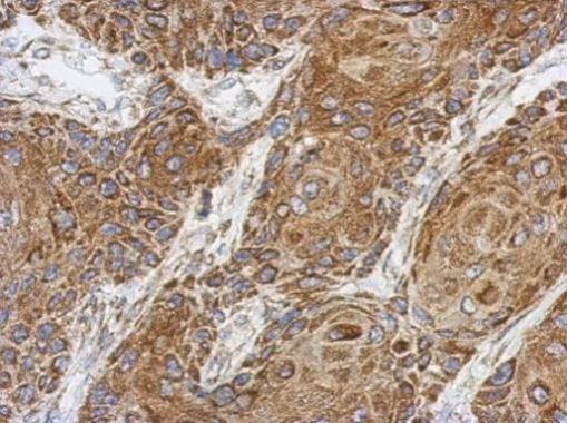 Anti-C1orf111 antibody used in IHC (Formalin-fixed paraffin-embedded sections). GTX107187