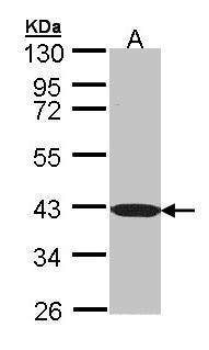 Anti-C1orf165 antibody [N1C1] used in Western blot. GTX107228