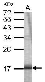 Anti-C1orf25 antibody [C2C3], C-term used in WB-Ag. GTX116906