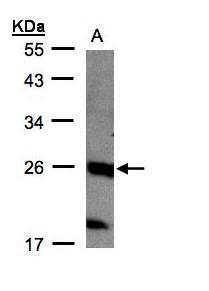 Anti-C1orf57 antibody [C2C3], C-term used in Western blot. GTX108326