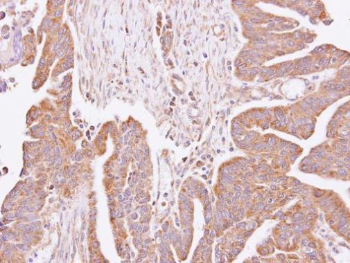 Anti-C4orf19 antibody [N3C3] used in IHC (Formalin-fixed paraffin-embedded sections). GTX106538