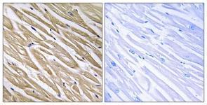 Anti-C5orf13 antibody used in IHC (Formalin-fixed paraffin-embedded sections). GTX87670