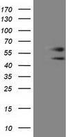 Anti-C9orf41 antibody [4A2] used in Western blot. GTX84742