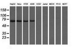 Anti-C9orf41 antibody [4B7] used in Western blot. GTX84743