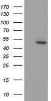 Anti-C9orf41 antibody [6A2] used in Western blot. GTX84744