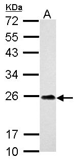 Anti-C9orf72 antibody used in Western blot. GTX119776