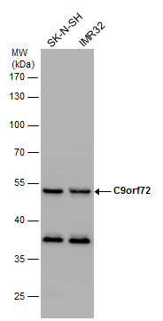 Anti-C9orf72 antibody used in Western blot. GTX127908