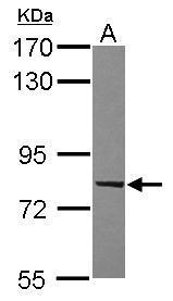 Anti-C9orf86 antibody [N1N3] used in Western blot. GTX117887