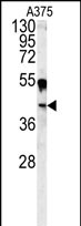 Anti-CA14 antibody, N-term used in Western blot. GTX81537