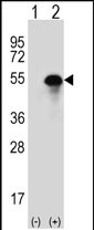 Anti-CA14 antibody, N-term used in Western blot. GTX81537
