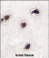 Anti-CABP1 antibody, C-term used in IHC (Formalin-fixed paraffin-embedded sections). GTX81376