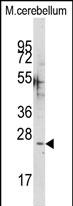 Anti-CABP1 antibody, C-term used in Western blot. GTX81376