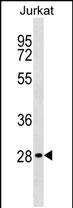 Anti-CABP1 antibody, C-term used in Western blot. GTX81376