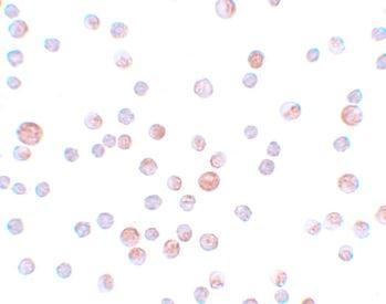 Anti-CaBP7 antibody used in ICC/IF. GTX85169