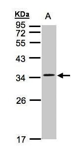 Anti-CACNG5 antibody used in Western blot. GTX103664