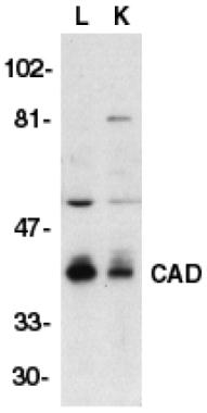 Anti-CAD antibody used in Western blot. GTX28400