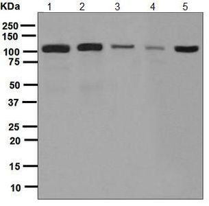 Anti-Cadherin-9 antibody [EPR5113] used in Western blot. GTX63647