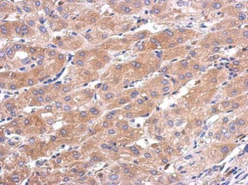 Anti-CALML5 antibody [N1C3] used in IHC (Formalin-fixed paraffin-embedded sections). GTX119159