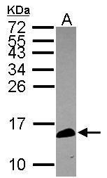 Anti-CALML5 antibody [N1C3] used in Western blot. GTX119159