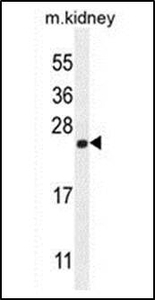 Anti-Calmodulin-like 4 antibody used in Western blot. GTX53476