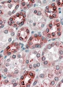 Anti-Calnexin antibody, Internal (near N-term) used in IHC (Formalin-fixed paraffin-embedded sections). GTX88369