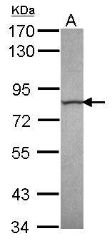 Anti-Calpain 13  antibody [C1C3] used in Western blot. GTX118394