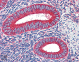 Anti-Calreticulin antibody [FMC 75] used in Immunohistochemistry. GTX42683