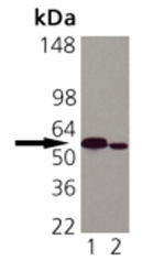 Anti-Calreticulin antibody [FMC 75] used in Western blot. GTX42683