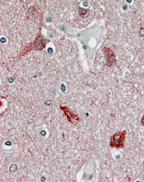 Anti-CAMKII alpha antibody, Internal used in IHC (Formalin-fixed paraffin-embedded sections). GTX88413