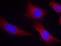 Anti-CaMKII antibody used in ICC/IF. GTX50706