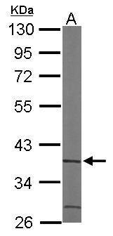 Anti-ACMSD antibody [N2C3] used in Western blot. GTX106739