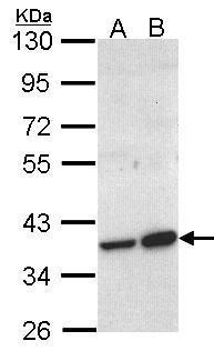 Anti-ACMSD antibody [N2C3] used in Western blot. GTX106739