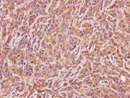Anti-ACMSD antibody [N2C3] used in IHC (Formalin-fixed paraffin-embedded sections). GTX106739