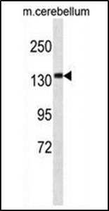 Anti-CAMSAP3 antibody used in Western blot. GTX53507