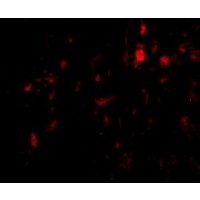 Anti-CAPN6 antibody used in ICC/IF. GTX85383