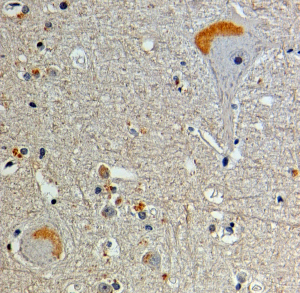 Anti-CAPON / NOS1AP antibody, N-term used in IHC (Formalin-fixed paraffin-embedded sections). GTX89878