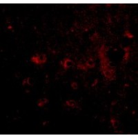 Anti-CAPS2 antibody used in ICC/IF. GTX85405