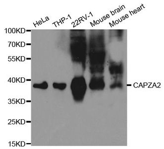 Anti-CAPZA2 antibody used in Western blot. GTX53918