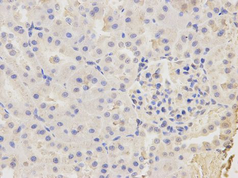 Anti-CAPZA2 antibody used in IHC (Formalin-fixed paraffin-embedded sections). GTX53918