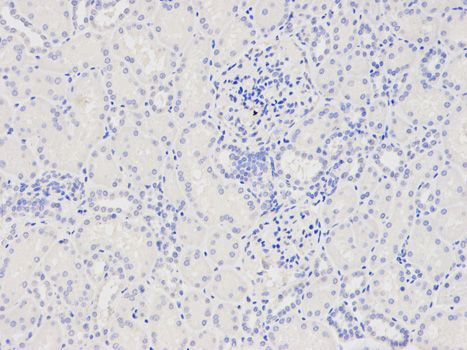 Anti-CAPZA2 antibody used in IHC (Formalin-fixed paraffin-embedded sections). GTX53918