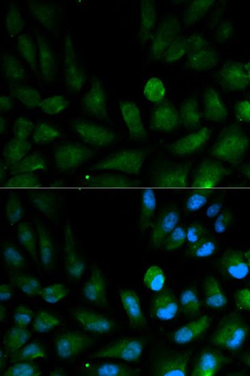 Anti-CAPZA2 antibody used in ICC/IF. GTX53918