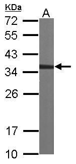Anti-CAPZA2 antibody [N2C3] used in Western blot. GTX114303